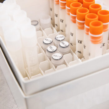 Diepvries labels voor laboratorium